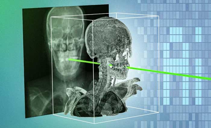 Mit, un aiuto dall’AI per la chirurgia mininvasiva